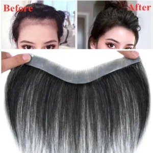Human Hairline Replacement System (PU, Non-Remy)