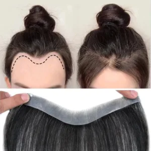 Anemone Baby Hair Bangs Hairline System (Remy)